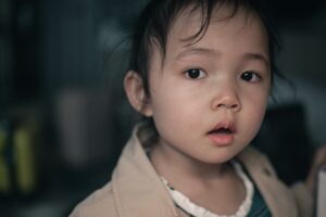 ¿Qué es el síndrome de Kabuki? Conoce sus principales síntomas