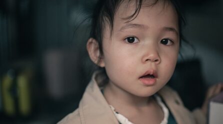 ¿Qué es el síndrome de Kabuki? Conoce sus principales síntomas