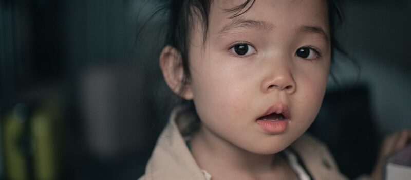 ¿Qué es el síndrome de Kabuki? Conoce sus principales síntomas